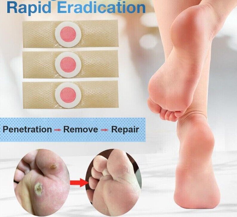 Foot Care Medical Plaster Feet Corn Plasters Removal Plantar Warts Pain Calluses